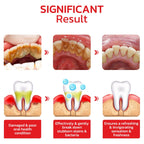 Original™ SP4 Ultra Teeth Whitening Toothpaste (Buy 1 Get 2)