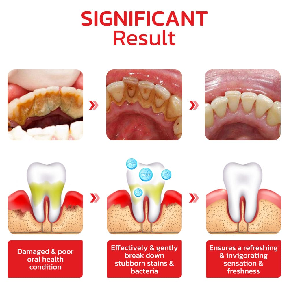 Original™ SP4 Ultra Teeth Whitening Toothpaste (Buy 1 Get 2)